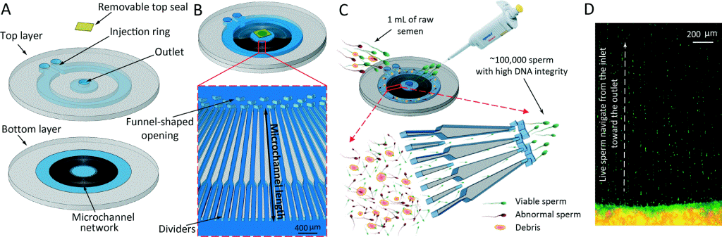 Sperm selection based on DNA integrity allows to use the highest quality sperm cells during IVF treatments.