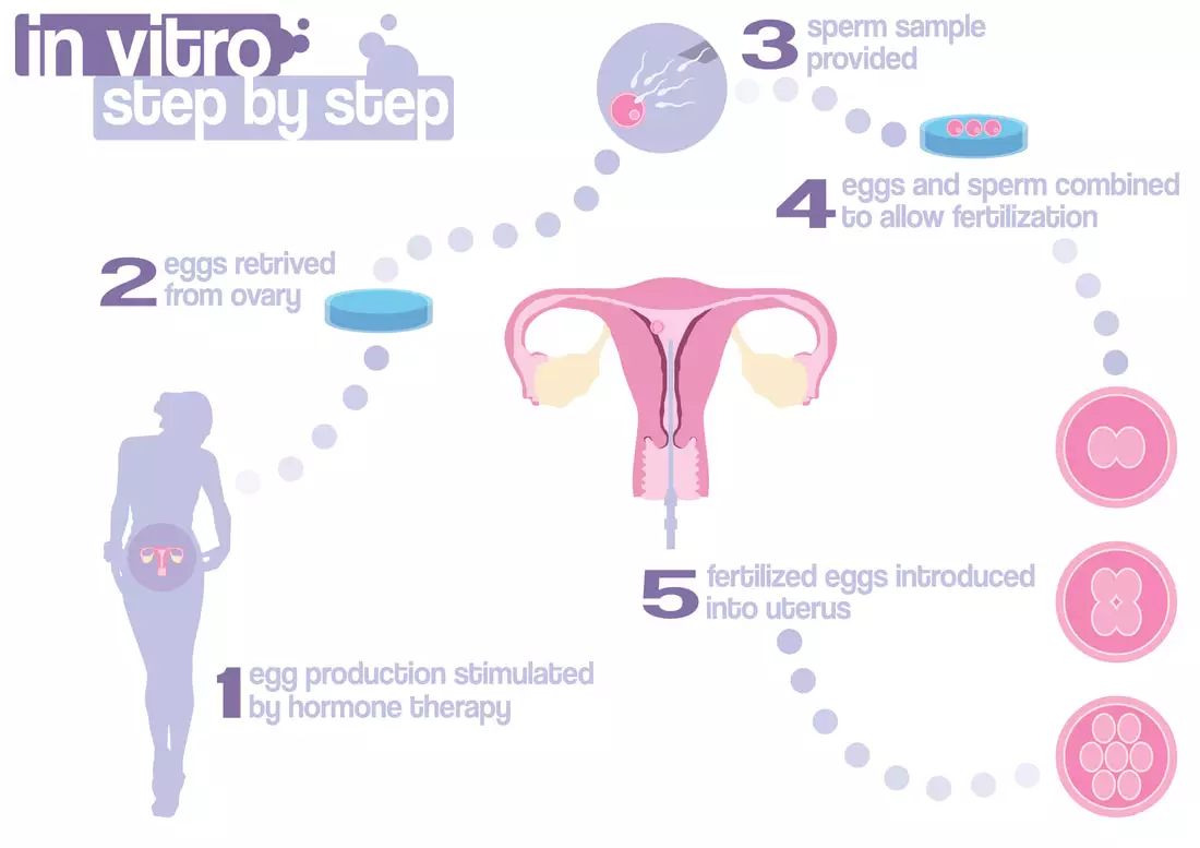 Step by step IVF treatment procedures at North Cyprus IVF Center