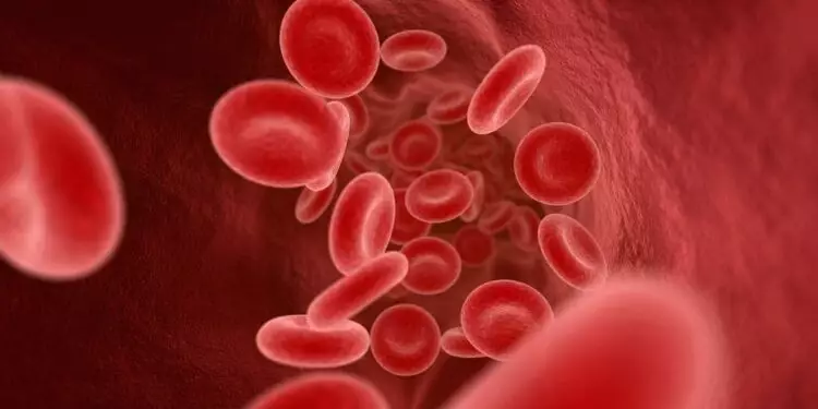 Sickle Cell Disease Prevention
