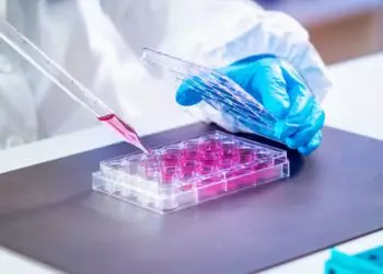 Terapia con células madre para pacientes que sufren de azoospermia no obstructiva